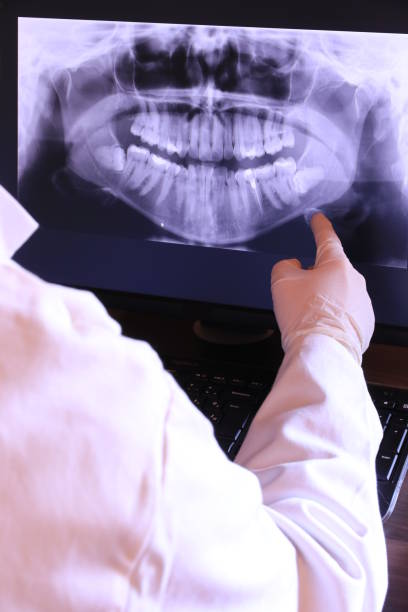 Best Emergency Dentist for Lost Fillings or Crowns in Hopewell, TN